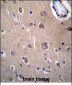 SLC8A3 Antibody (C-term)